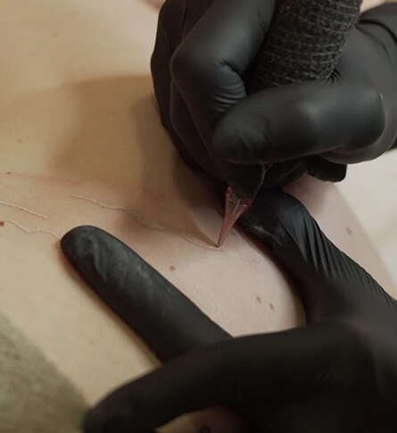 Soin bien-être Dermopigmentation réparatrice vergeture